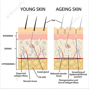مقایسه پوست جوان و سالم و پوست پیر و چروکیده