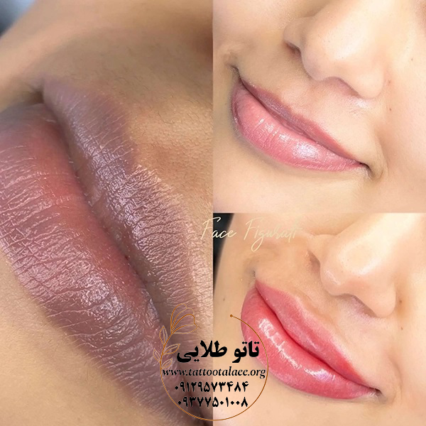 آیا شیدینگ لب سرطان زاست